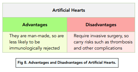 Cardiovascular Disease: Artificial Hearts and Transplants